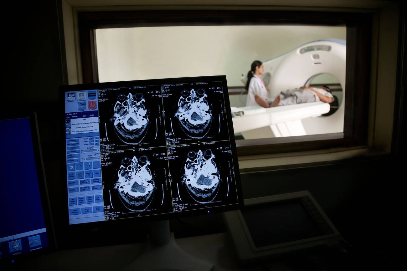 Head Injury (TBI)