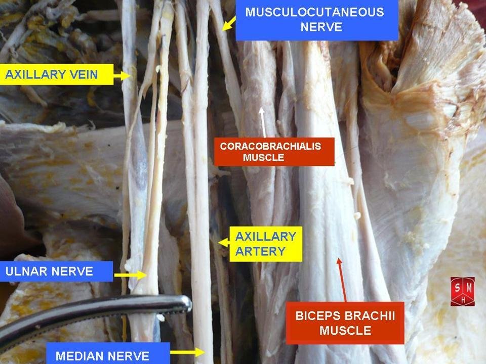 Nerve Decompression