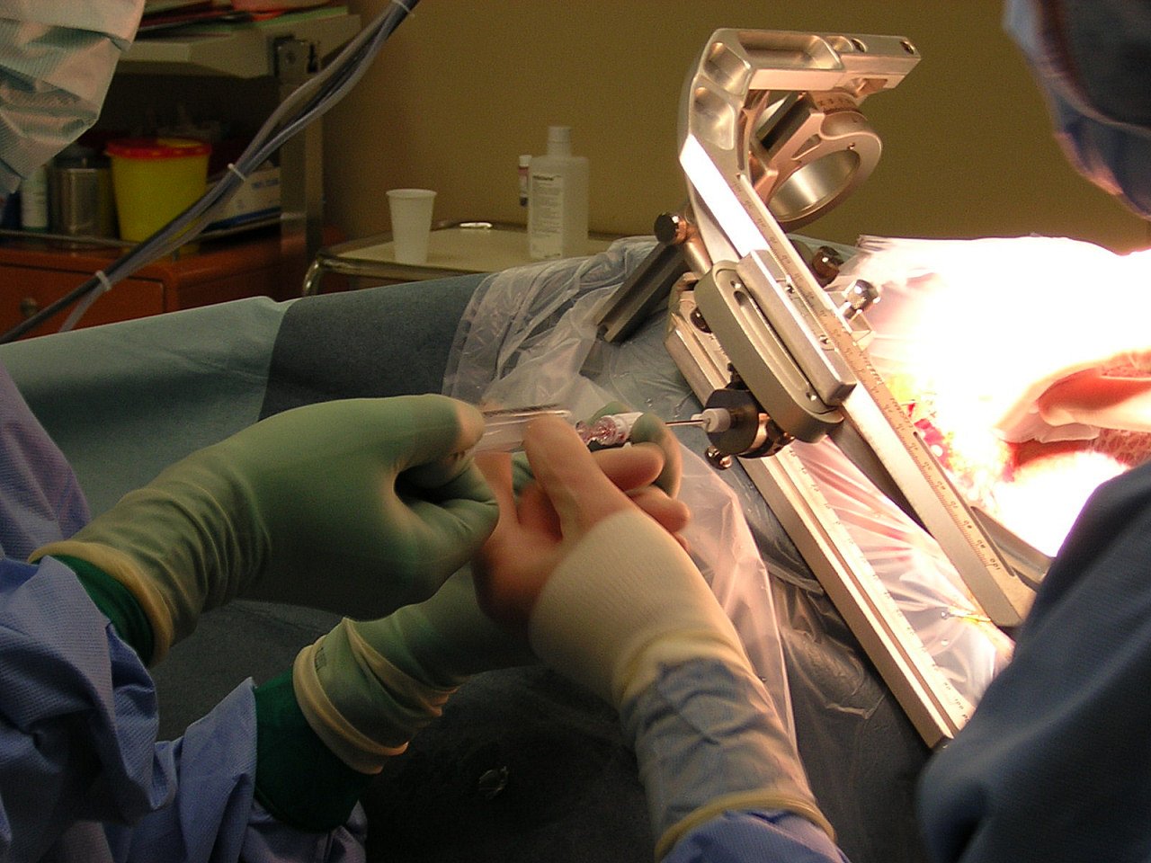 Stereotactic Biopsy